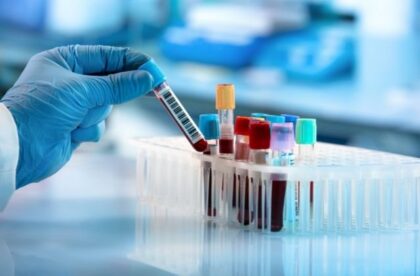 Safety Precautions To Take When Handling Test Samples