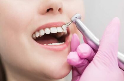 why see you dentist every six months