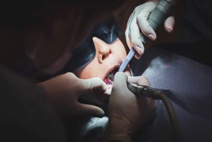 wisdom teeth surgery