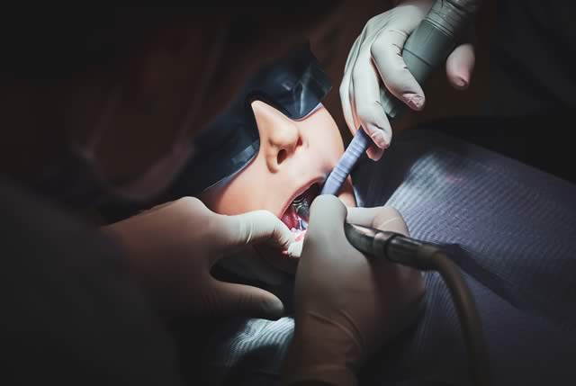 wisdom teeth surgery